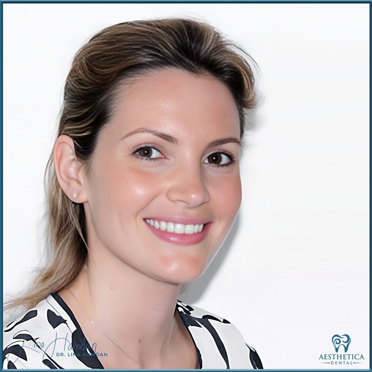 Inman aligners: anonymous case 69 from Aesthetica Dental Naperville