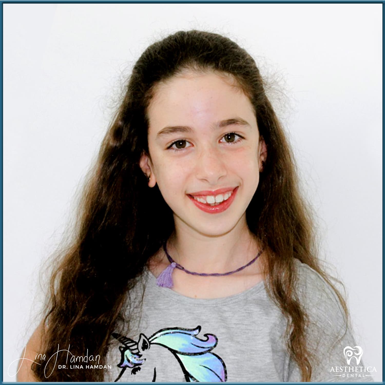 A full re-design of the smile: anonymous case 23 from Aesthetica Dental Naperville
