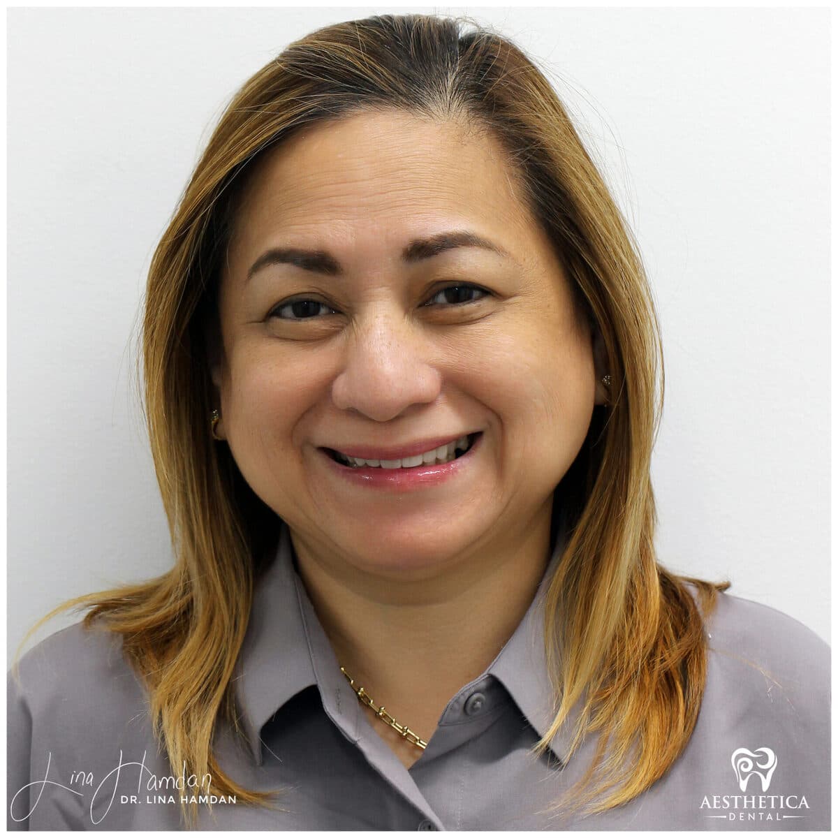 Considered porcelain veneers: anonymous case 20 from Aesthetica Dental Naperville