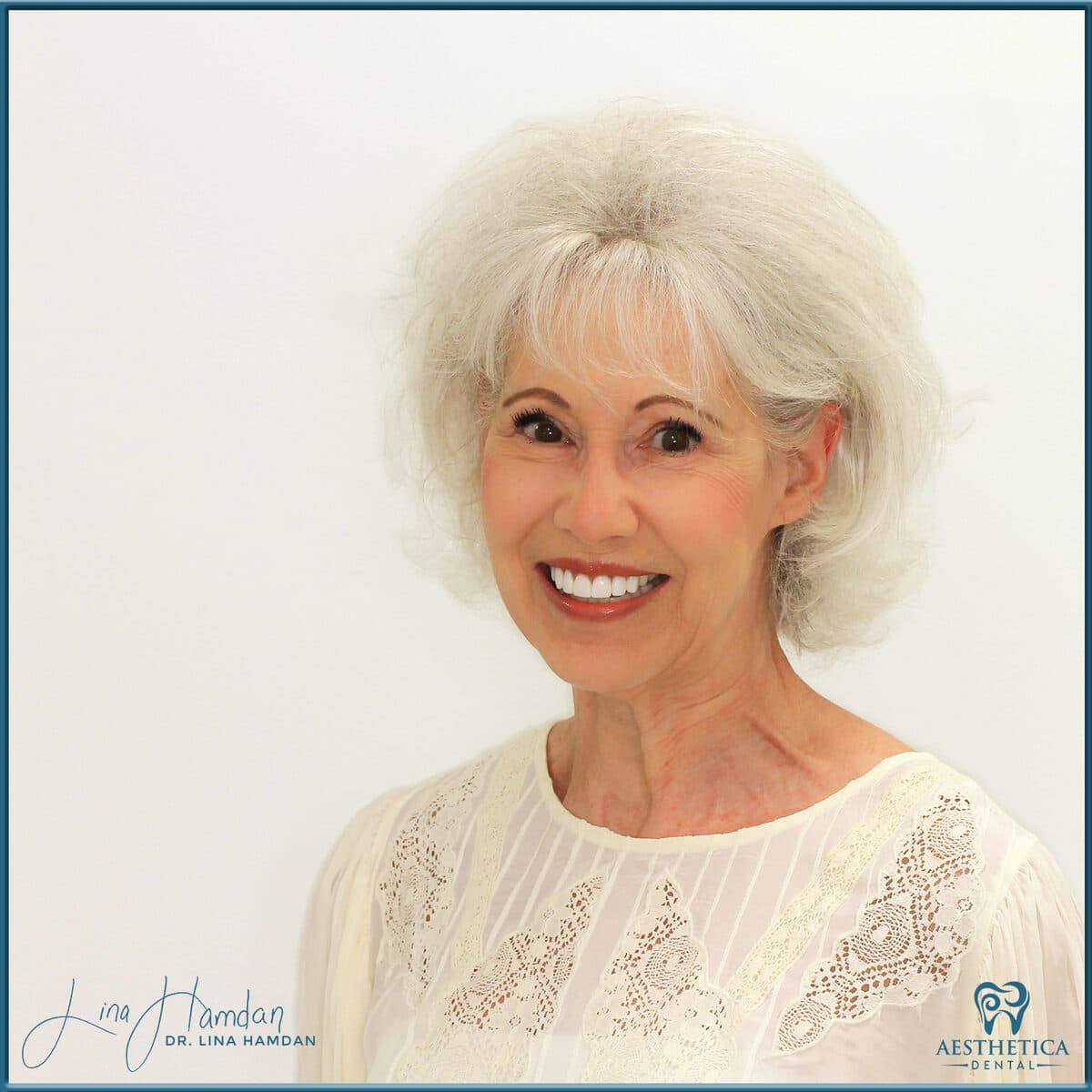 Considered porcelain veneers: anonymous case 63 from Aesthetica Dental Naperville
