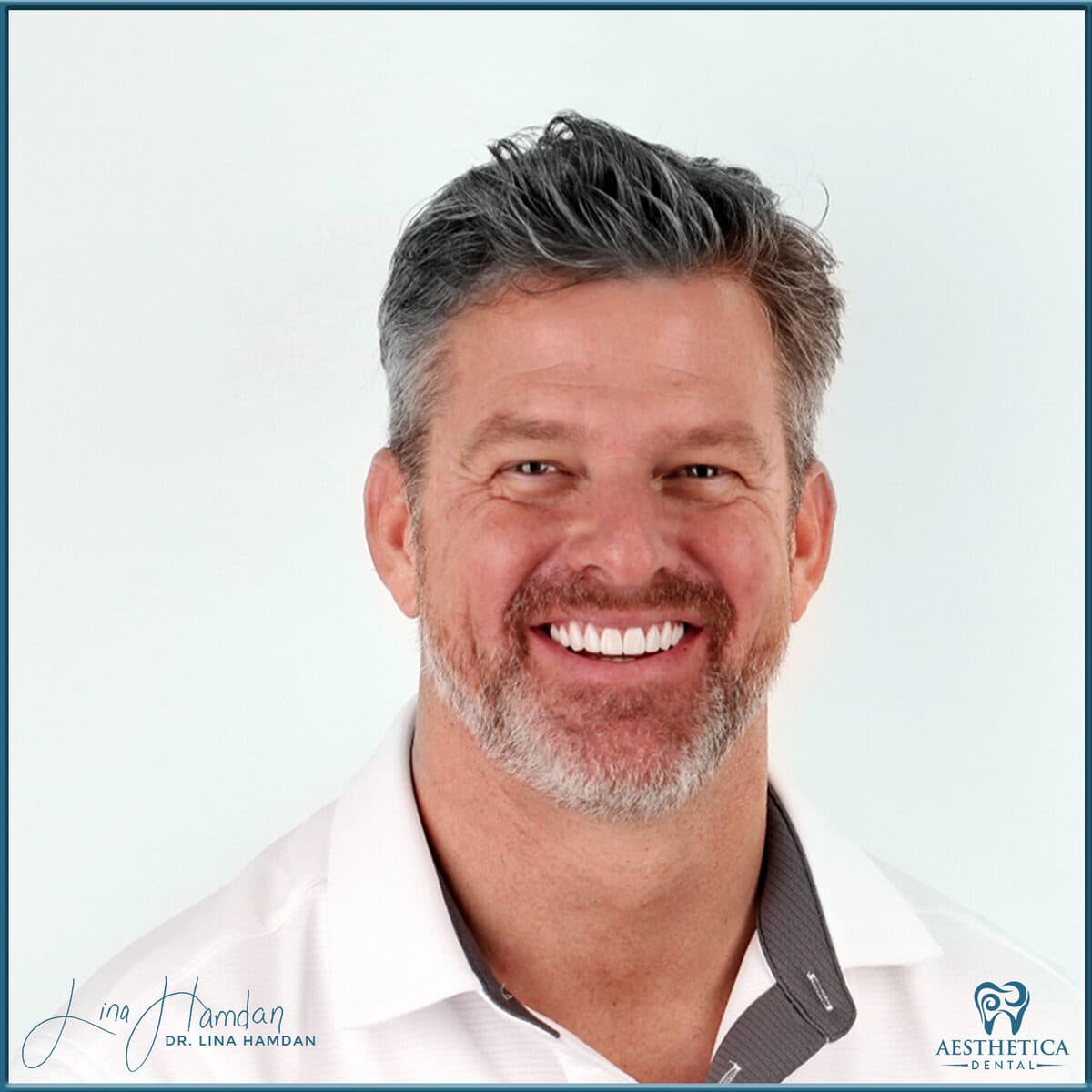 Considered porcelain veneers: anonymous case 66 from Aesthetica Dental Naperville