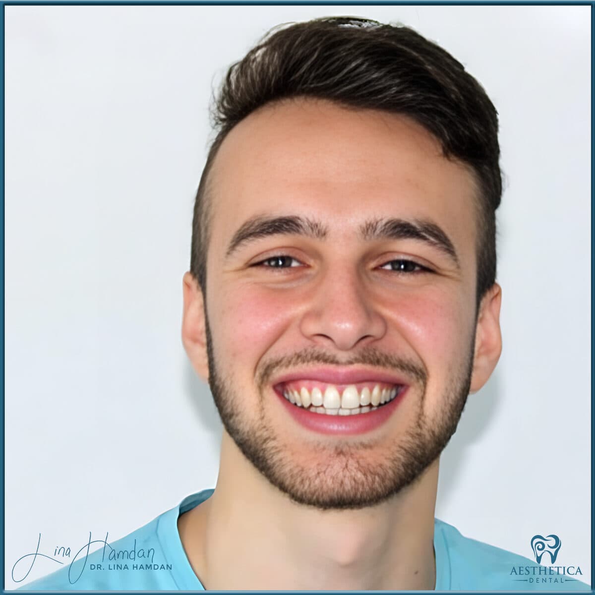 Teeth whitening case 8, anonymous patient at Aesthetica Dental Naperville, photo 1