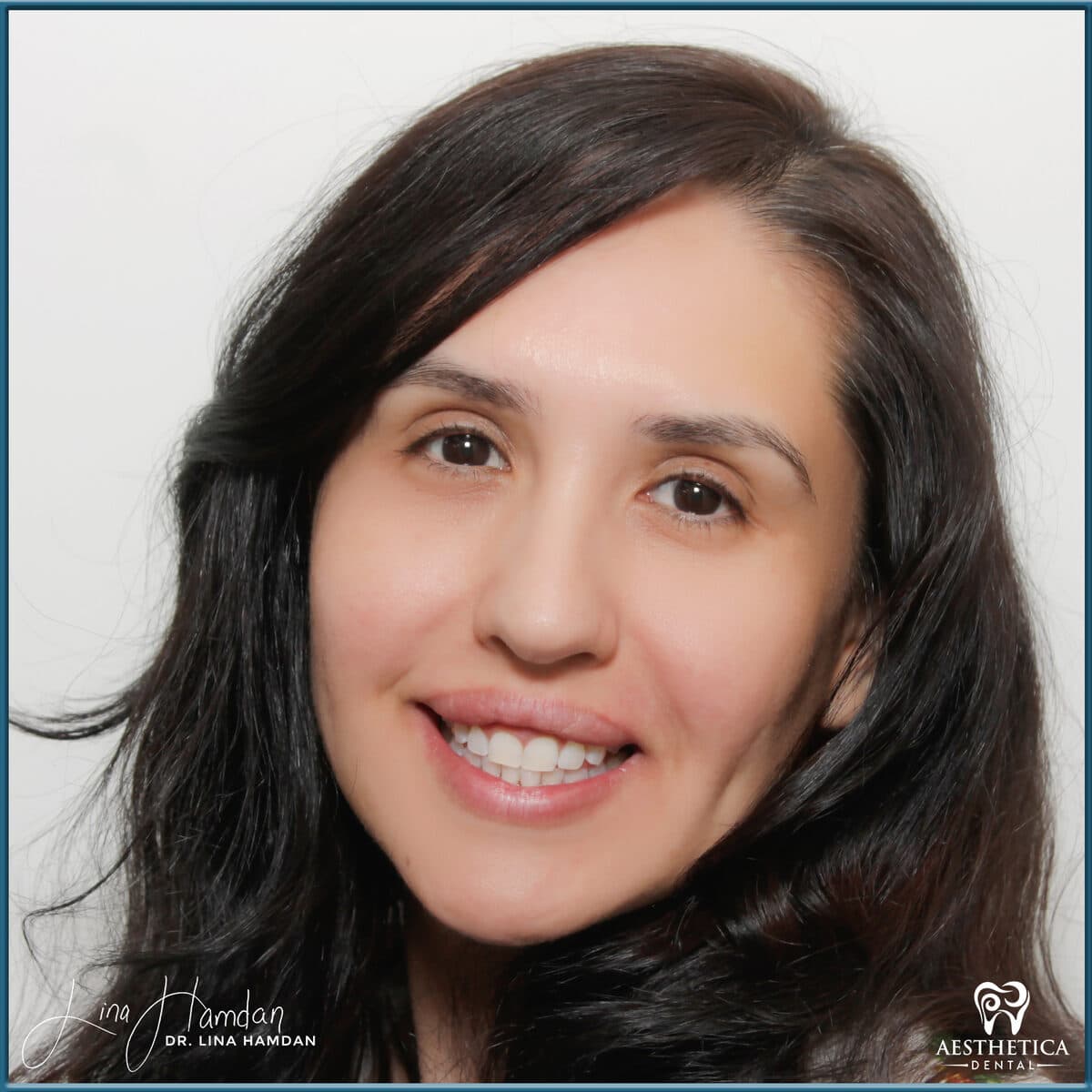 Teeth whitening case 14, anonymous patient at Aesthetica Dental Naperville, photo 1