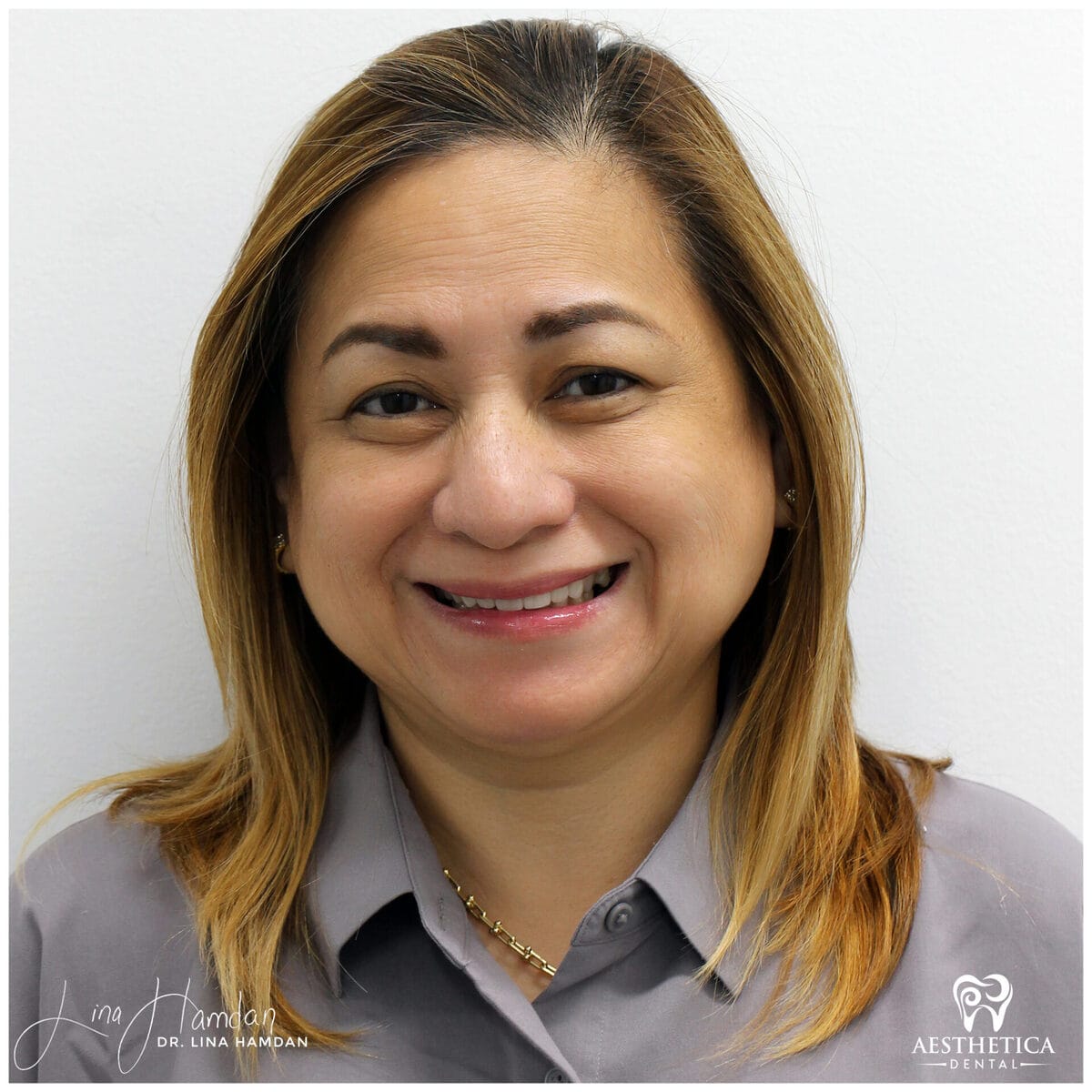 Considered porcelain veneers: anonymous case 20 from Aesthetica Dental Naperville