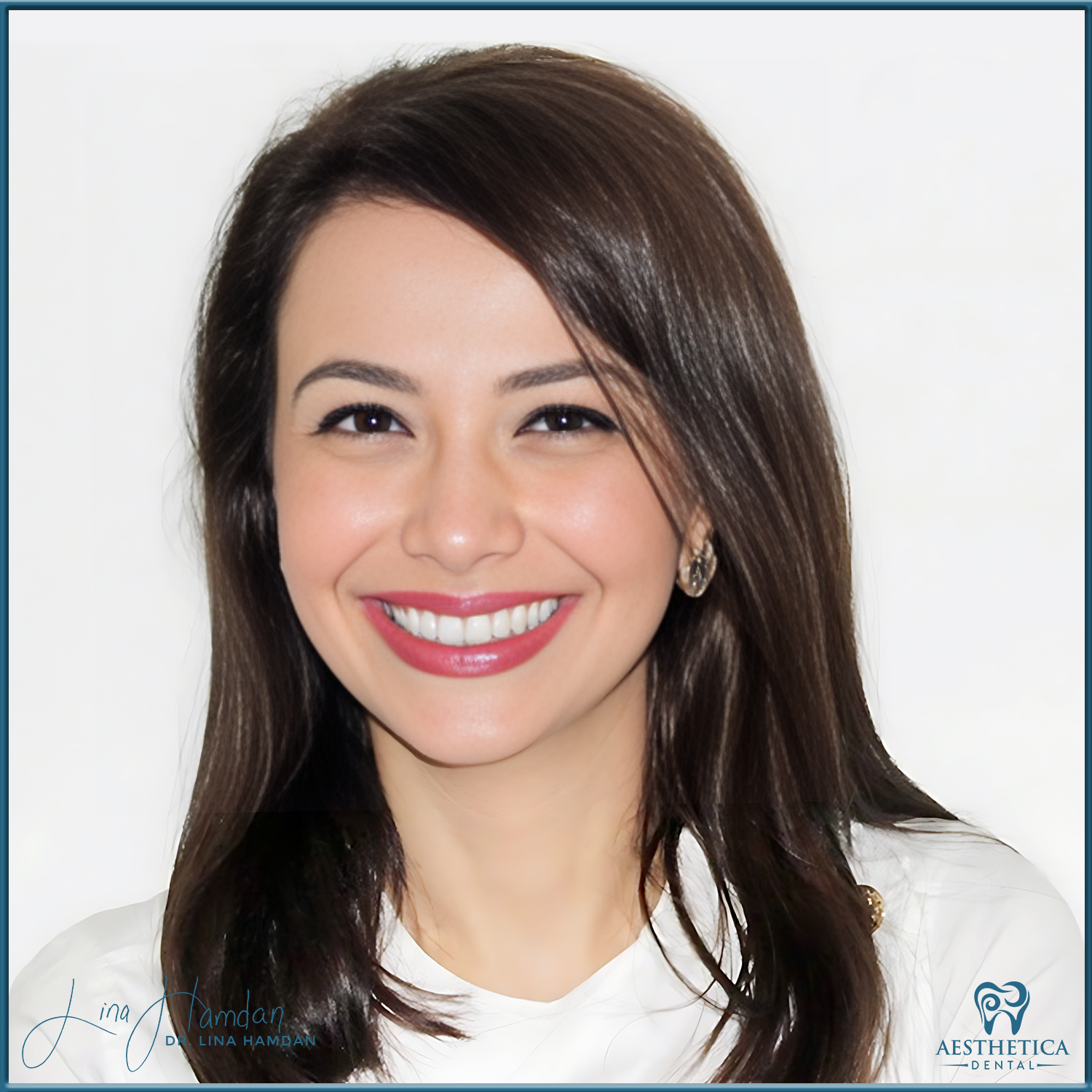 Porcelain Veneers case 3 done by Dr. Lina Hamdan. - Before and After Images - 1