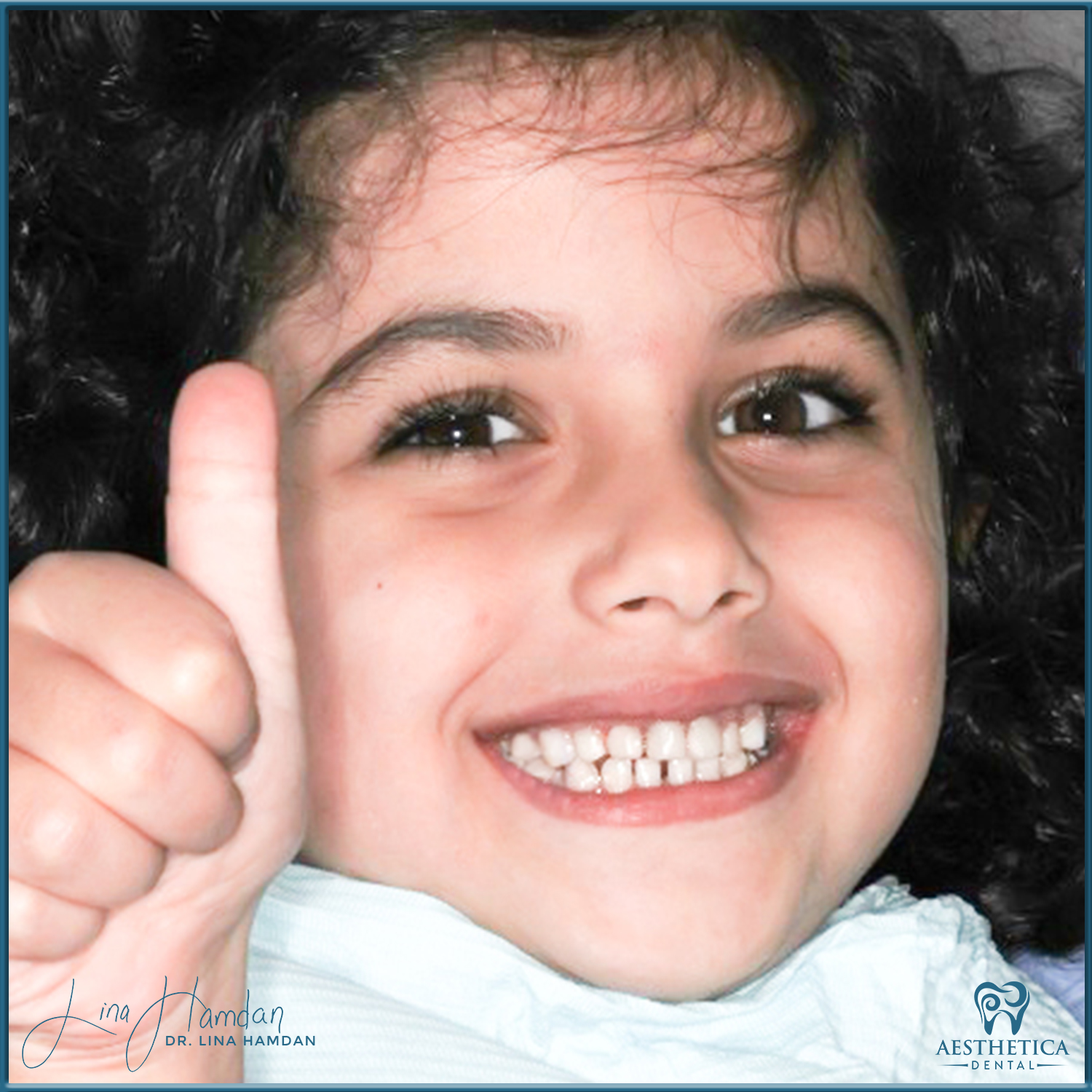 Dental Composite Bonding case 12 done by Dr. Lina Hamdan. - Before and After Images - 1